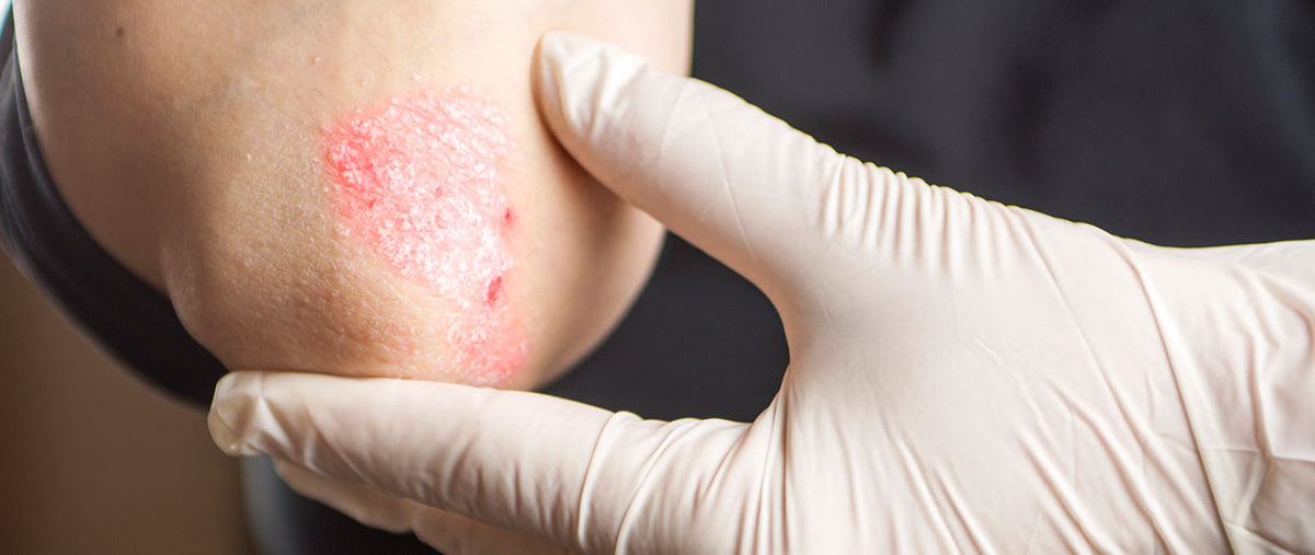 4 Mushrooms For Energy AllNatural And Sustainable Fuel Natures Rise